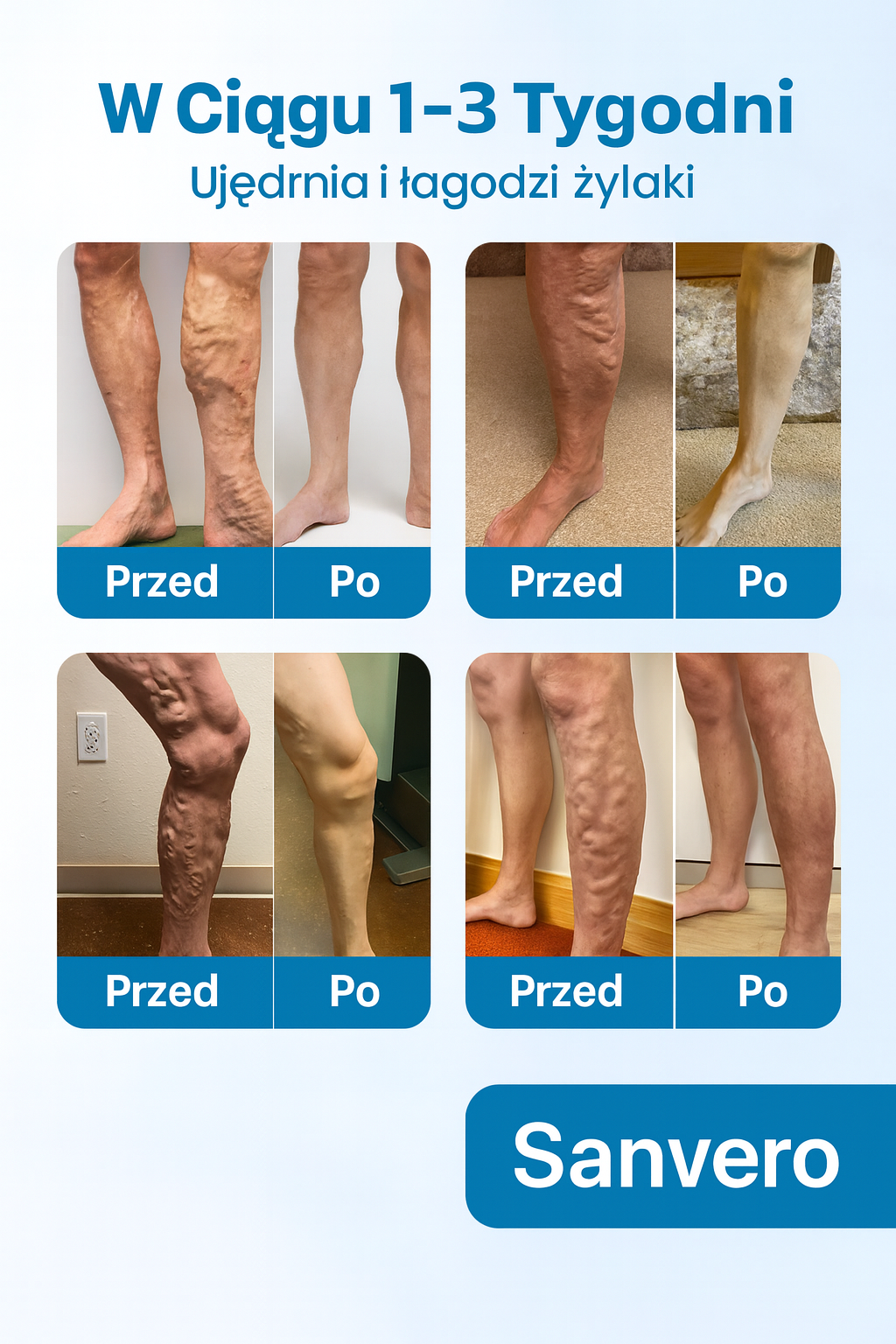 Sanvero - Sprej na żylaki